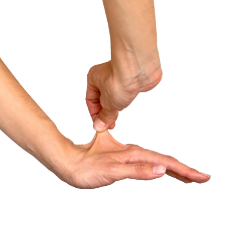 Ehlers-Danlos-Syndrome-Aurelio-Performance-Physical-Therapy-Scottsdale-AZ